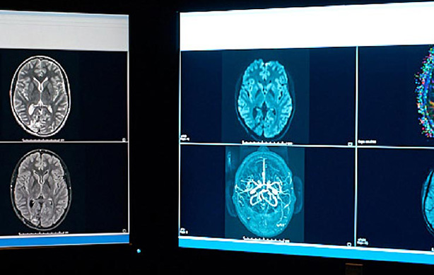 ChRIS project brain scans on computer monitors