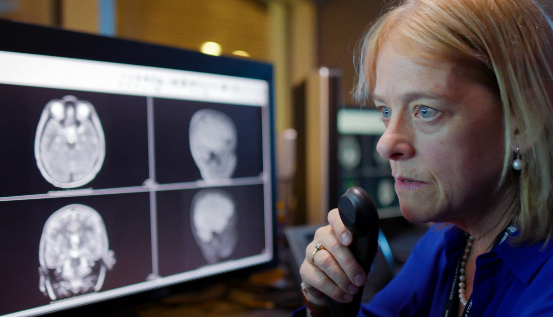 Woman analyzing MRI imaging results of a brain