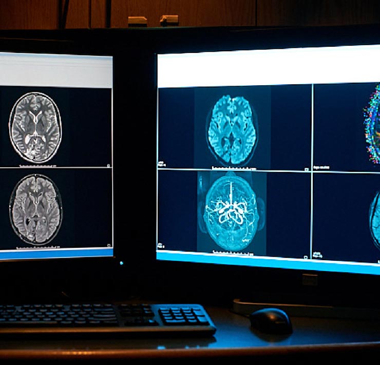 ChRIS project brain scans on computer monitors